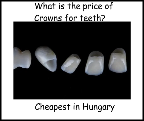 What is the price of crowns for teeth image