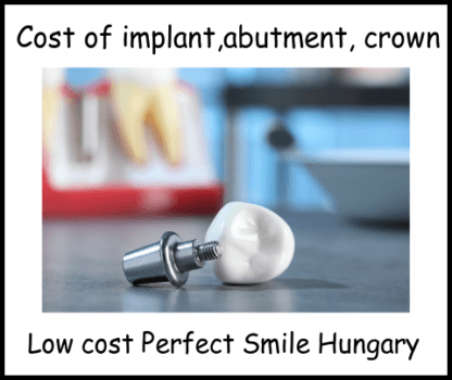 Cost of Implant, Abutment. Crown imsge