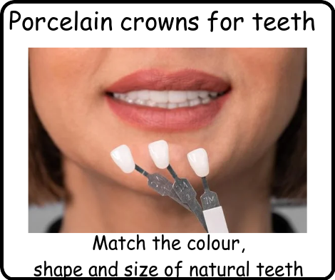 Porcelain crowns for teeth image