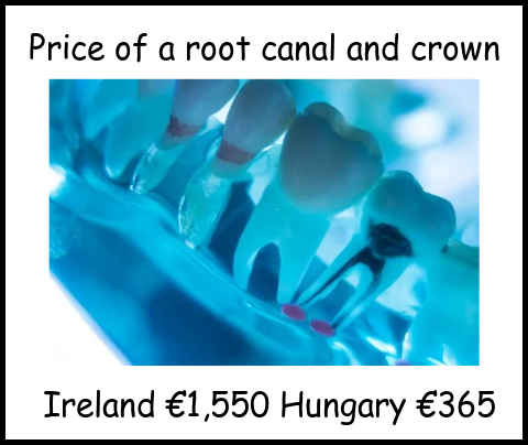 Price of a root canal and crown comparison image