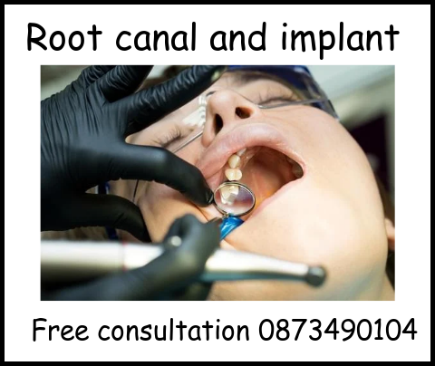 Root canal and implant