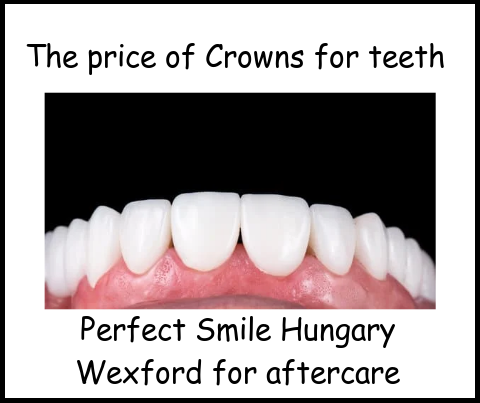 The price of crowns for teeth image