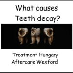 What causes teeth decay image
