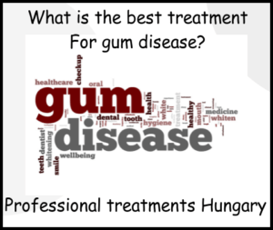 What is the best treatment for gum disease image