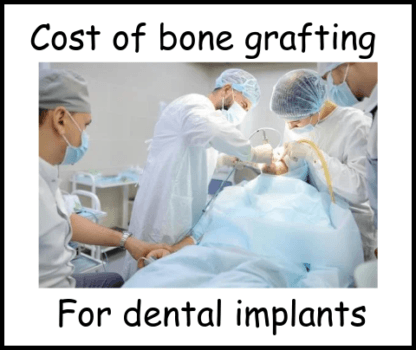 Cost of bone grafting for dental implants