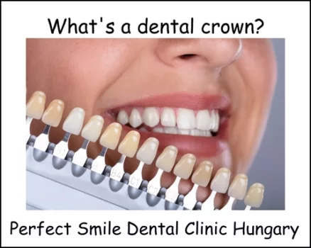 What’s a dental crown
