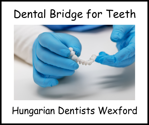 Dental bridge for teeth image