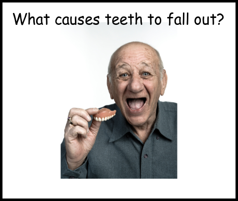 What causes teeth to fall out image