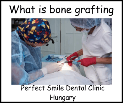 What is bone grafting Perfect Smile Dental Clinic Hungary image