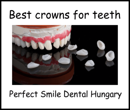 Best crowns for teeth perfect Smile Dental Clinic image