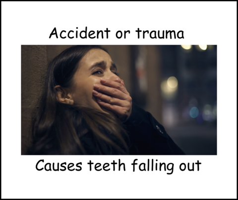 Addident or trauma causes teeth to fall out image