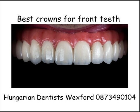 Best crowns for front teeth image