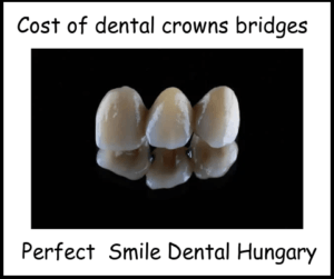 Cost of dental crowns bridges image