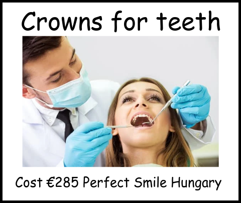 Crowns for teeth image 