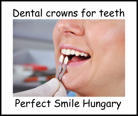 Dental crowns for teeth image