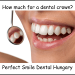 How much for a dental crown image