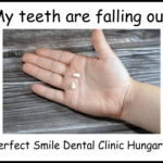 My teeth are falling out image