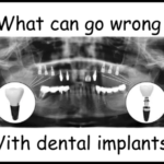 What can go wrong with dental implants
