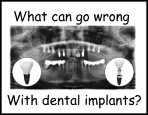 What can go wrong with dental implants