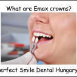 What are Emax crowns image