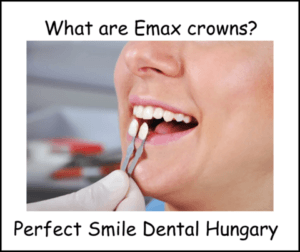 What are Emax crowns image