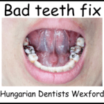 Bad teeth fix image