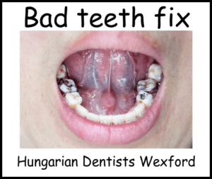 Bad teeth fix image