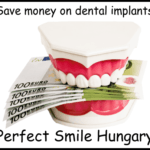 Save money on dental implants image