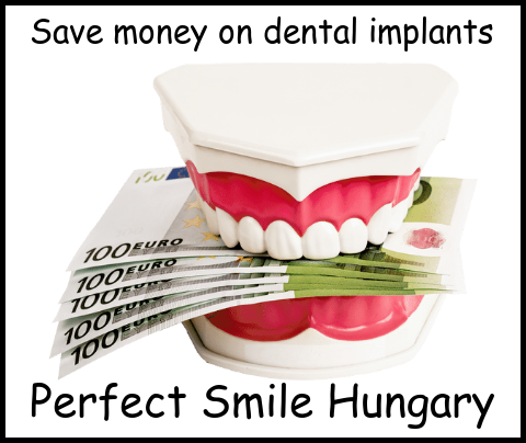 Save money on dental implants image