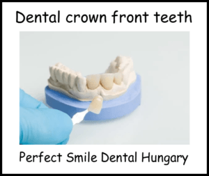 Dental crowns front teeth image