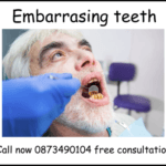 My teeth are embarrassing image