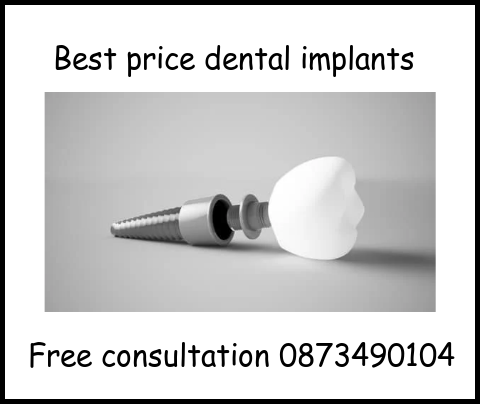 Best price dental implants free consultation image