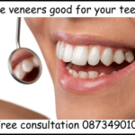 Are veneers good for your teeth image