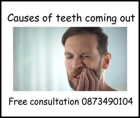 Causes of teeth coming out image