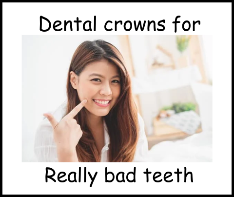 Dental crowns for really bad teeth image