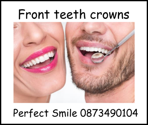 Front teeth crowns image