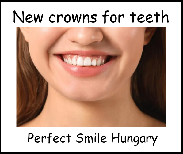 New crowns for teeth image