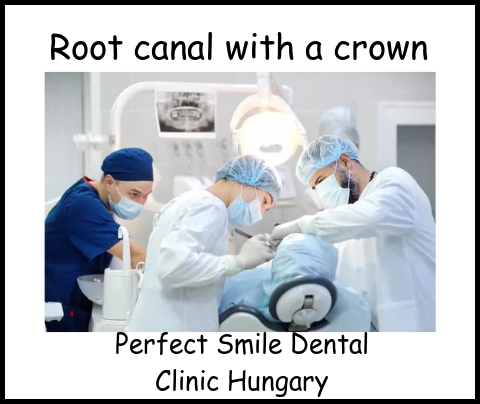 Root canal with a crown image