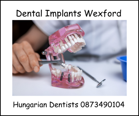 Dental implants Wexford image