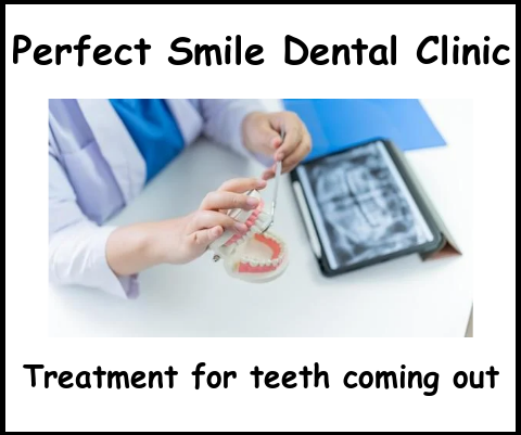 Treatment for teeth coming out Perfect Smile dental clinic image