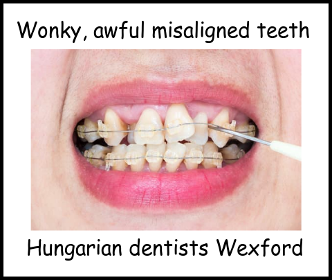 Wonky, awful, misaligned teeth image