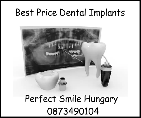 Best price dental implants Perfect Smile Hungary image