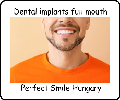 Dental implants full mouth image