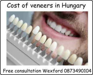 Cost of veneers in Hungary image