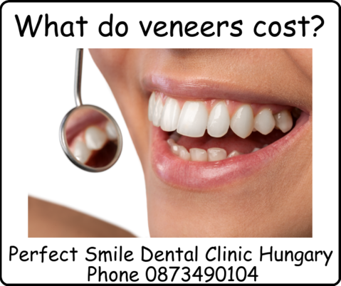 What do veneers cost image