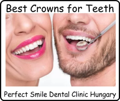 Best dental crowns for teeth