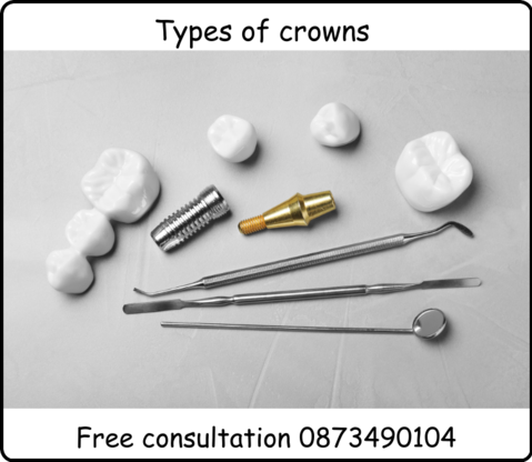 Types of crowns that dentist do image 