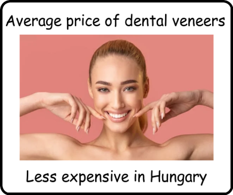 Average cost of dental veneers image