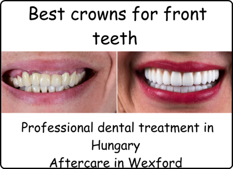 Best crowns for front teeth image 1