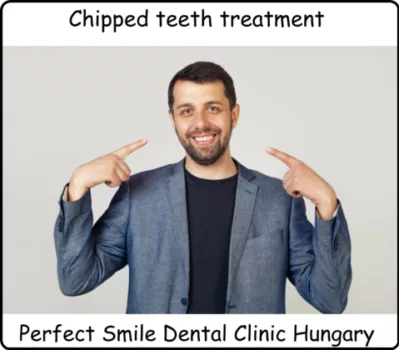 Chipped teeth treatment